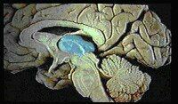 a view of the core brain and its cortical superstructure