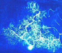 a cerebellar neuron
