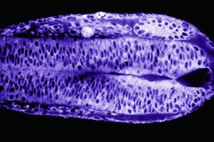 an embryo forming its neural tube