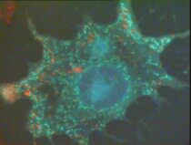 Fluorescence microscopy of a cell: blue = nucleic acids, green = mitochondia, red = lysosomes.