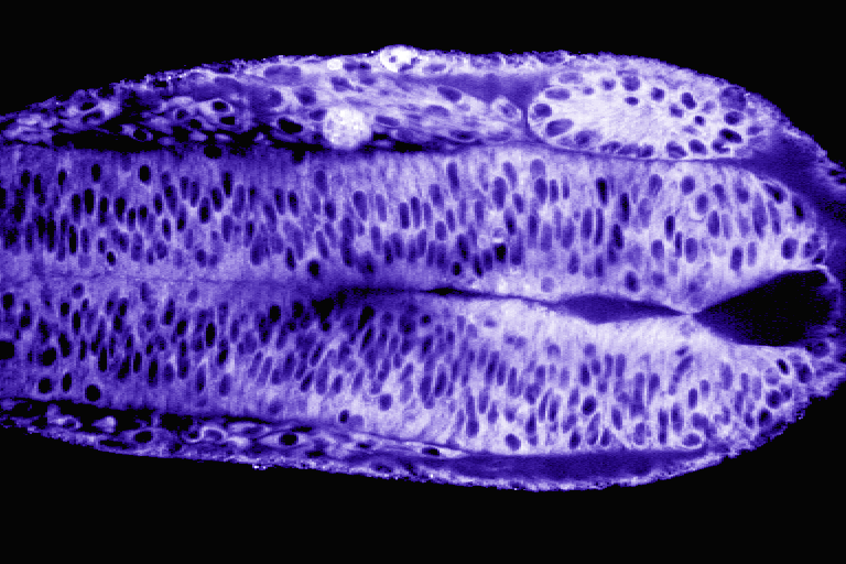 an embryo forming its neural tube