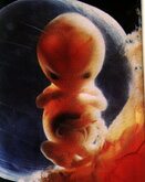 human embryo